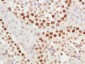 METTL11A Polyclonal Antibody
